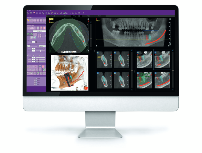 informatique-cabinets-dentaires
